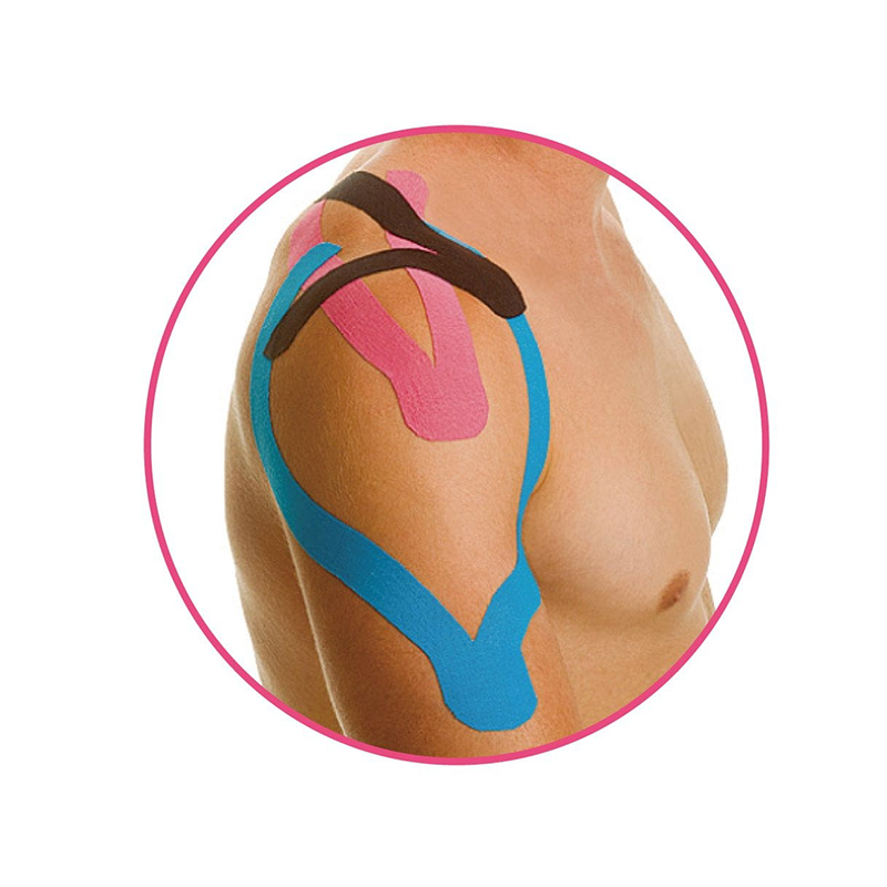 แพทช์จีโนโลยีฉันพิมพ์