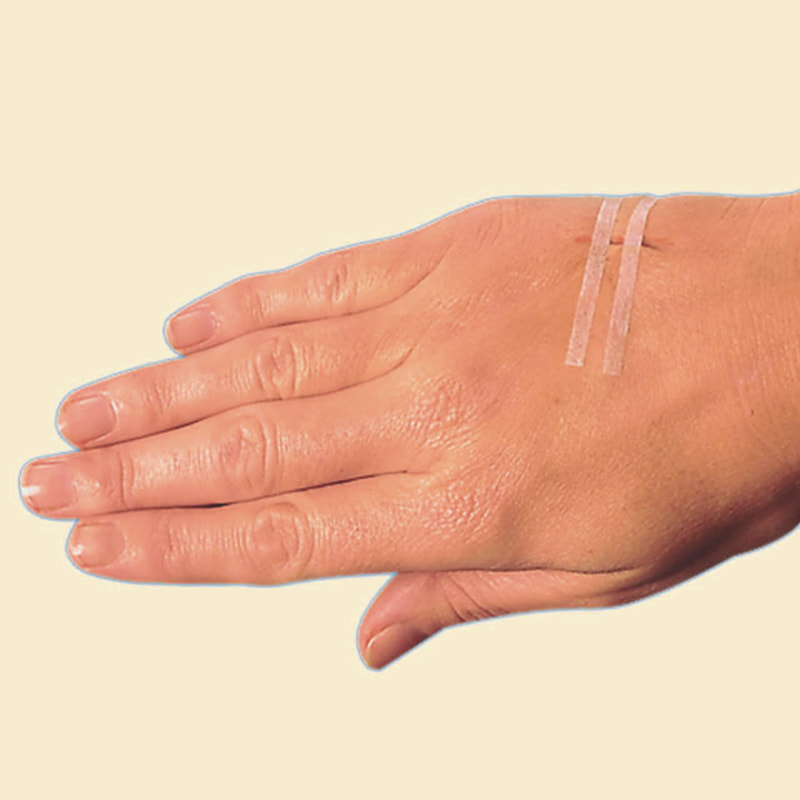 แถบปิดผิวหนัง