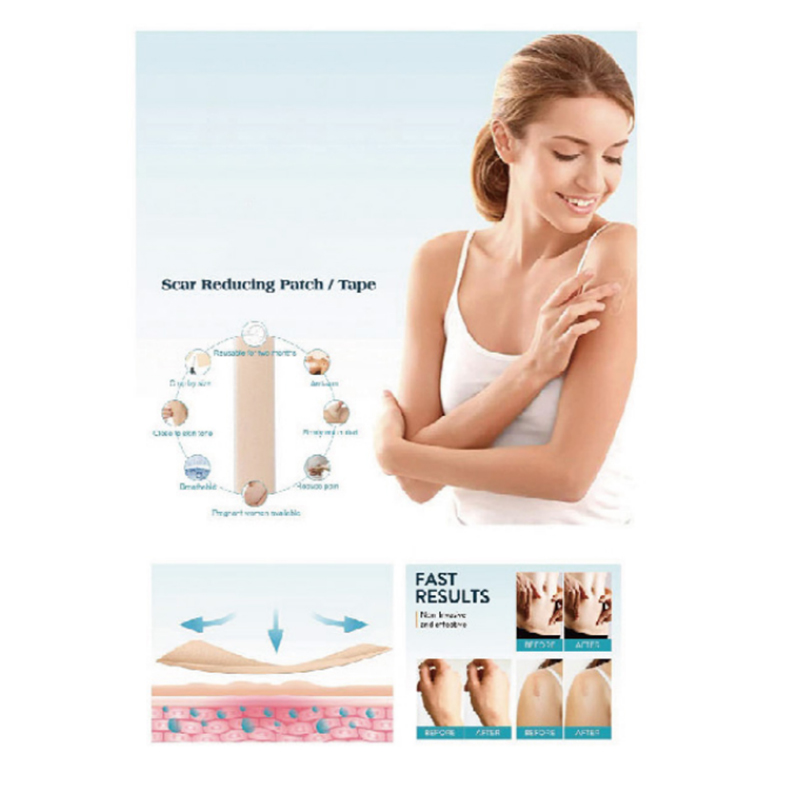 น้ำสลัดซิลิโคน